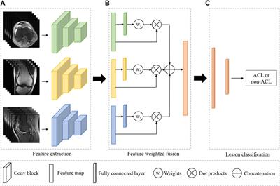 Automated diagnosis of anterior cruciate ligament via a weighted multi-view network